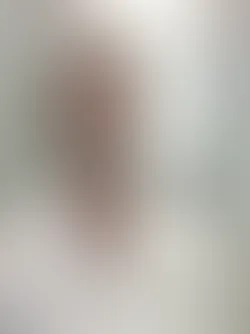 Foto Seroma Amazan
